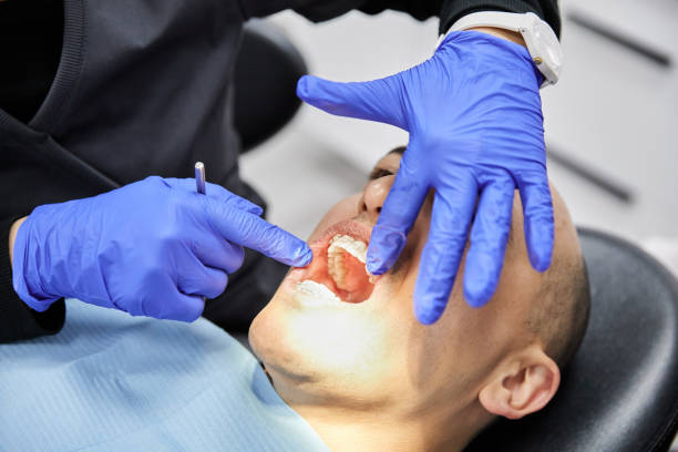 Best Knocked-Out Tooth (Avulsed Tooth) Treatment in Wathena, KS