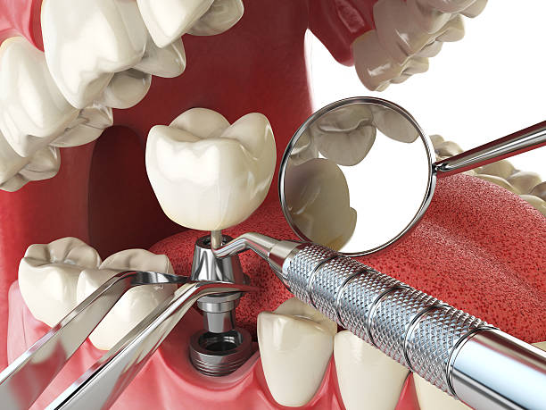 Best Emergency Root Canal Therapy in Wathena, KS